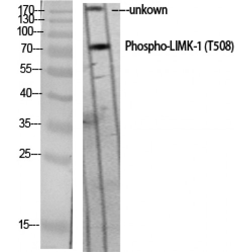 LIMK1 / LIMK Antibody - Western blot of Phospho-LIMK-1 (T508) antibody