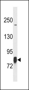LIMK1 / LIMK Antibody - LIMK1 Antibody (T9) western blot of SK-BR-3 cell line lysates (35 ug/lane). The LIMK1 antibody detected the LIMK1 protein (arrow).