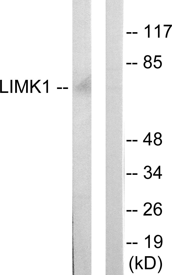 LIMK1 / LIMK Antibody - Western blot analysis of lysates from mouse brain, using LIMK1 Antibody. The lane on the right is blocked with the synthesized peptide.