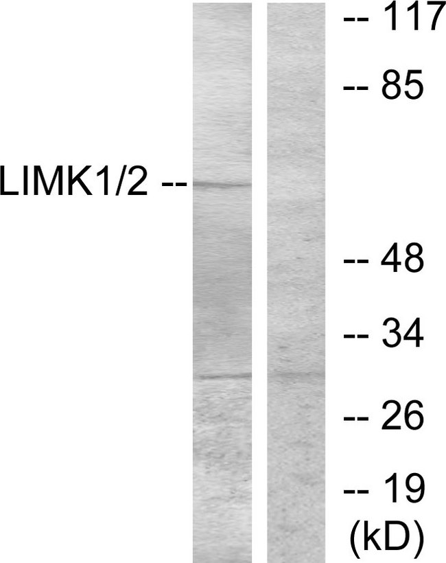 LIMK1 / LIMK Antibody - Western blot analysis of lysates from NIH/3T3 cells, treated with UV, using LIMK1 Antibody. The lane on the right is blocked with the synthesized peptide.