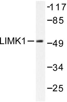 LIMK1 / LIMK Antibody - Western blot of LIMK1 (D502) pAb in extracts from NIH/3T3 treated with UV.