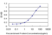 LIMK1 / LIMK Antibody - Detection limit for recombinant GST tagged LIMK1 is approximately 0.3 ng/ml as a capture antibody.
