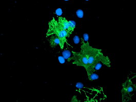 LIMK1 / LIMK Antibody - Anti-LIMK1 mouse monoclonal antibody immunofluorescent staining of COS7 cells transiently transfected by pCMV6-ENTRY LIMK1.