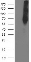 LIMK1 / LIMK Antibody - HEK293T cells were transfected with the pCMV6-ENTRY control (Left lane) or pCMV6-ENTRY LIMK1 (Right lane) cDNA for 48 hrs and lysed. Equivalent amounts of cell lysates (5 ug per lane) were separated by SDS-PAGE and immunoblotted with anti-LIMK1.