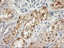 LIMK1 / LIMK Antibody - IHC of paraffin-embedded Human Kidney tissue using anti-LIMK1 mouse monoclonal antibody.