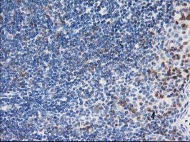 LIMK1 / LIMK Antibody - IHC of paraffin-embedded Human lymph node tissue using anti-LIMK1 mouse monoclonal antibody.