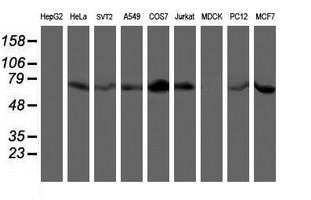 LIMK1 / LIMK Antibody - Western blot of extracts (35 ug) from 9 different cell lines by using anti-LIMK1 monoclonal antibody.
