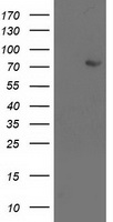 LIMK1 / LIMK Antibody - HEK293T cells were transfected with the pCMV6-ENTRY control (Left lane) or pCMV6-ENTRY LIMK1 (Right lane) cDNA for 48 hrs and lysed. Equivalent amounts of cell lysates (5 ug per lane) were separated by SDS-PAGE and immunoblotted with anti-LIMK1.