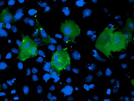 LIMK1 / LIMK Antibody - Anti-LIMK1 mouse monoclonal antibody immunofluorescent staining of COS7 cells transiently transfected by pCMV6-ENTRY LIMK1.