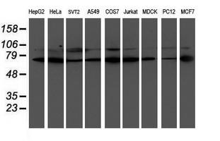LIMK1 / LIMK Antibody - Western blot of extracts (35 ug) from 9 different cell lines by using anti-LIMK1 monoclonal antibody (HepG2: human; HeLa: human; SVT2: mouse; A549: human; COS7: monkey; Jurkat: human; MDCK: canine; PC12: rat; MCF7: human).