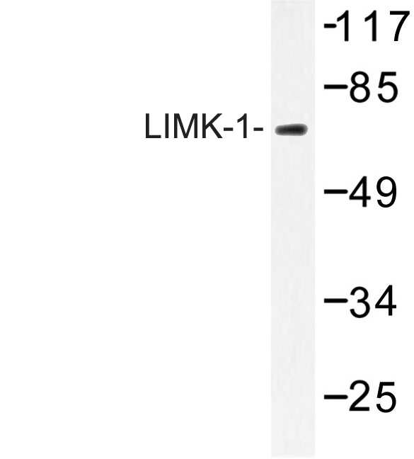 LIMK1 / LIMK Antibody - Western blot of IMK-1 (Q491) pAb in extracts from mouse brain.
