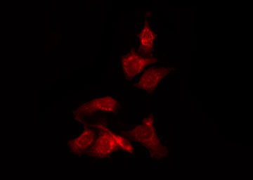 LIMK1 / LIMK Antibody - Staining NIH-3T3 cells by IF/ICC. The samples were fixed with PFA and permeabilized in 0.1% Triton X-100, then blocked in 10% serum for 45 min at 25°C. The primary antibody was diluted at 1:200 and incubated with the sample for 1 hour at 37°C. An Alexa Fluor 594 conjugated goat anti-rabbit IgG (H+L) Ab, diluted at 1/600, was used as the secondary antibody.