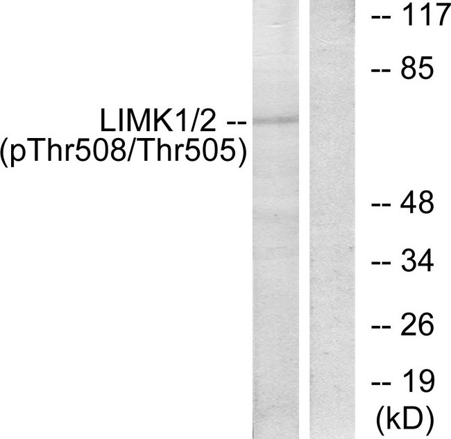 LIMK1 / LIMK Antibody - Western blot analysis of lysates from COLO205 cells, using LIMK1 (Phospho-Thr508) Antibody. The lane on the right is blocked with the phospho peptide.