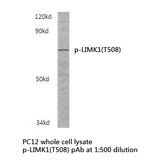 LIMK1 / LIMK Antibody - Western blot of p-LIMK1 (T508) pAb in extracts from PC12 cells.