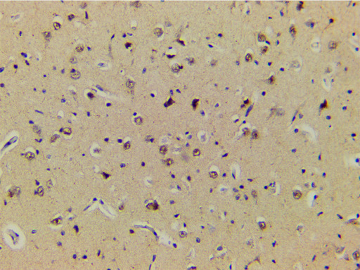 LIMK1 / LIMK Antibody - 1:200 staining human brain tissue by IHC-P. The tissue was formaldehyde fixed and a heat mediated antigen retrieval step in citrate buffer was performed. The tissue was then blocked and incubated with the antibody for 1.5 hours at 22°C. An HRP conjugated goat anti-rabbit antibody was used as the secondary.