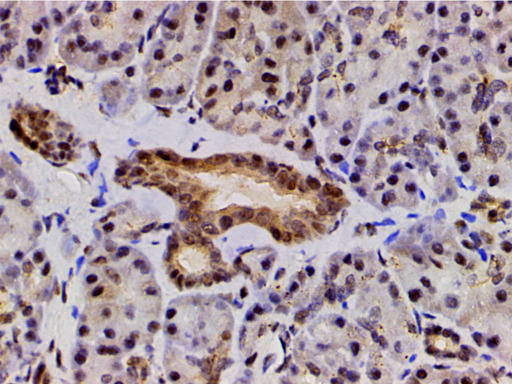 LIMK1 / LIMK Antibody - 1:200 staining human duodenum tissue by IHC-P. The tissue was formaldehyde fixed and a heat mediated antigen retrieval step in citrate buffer was performed. The tissue was then blocked and incubated with the antibody for 1.5 hours at 22°C. An HRP conjugated goat anti-rabbit antibody was used as the secondary.