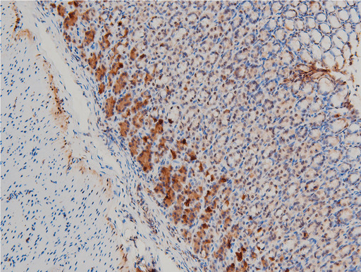 LIMK1 / LIMK Antibody - 1:100 staining rat gastric tissue by IHC-P. The tissue was formaldehyde fixed and a heat mediated antigen retrieval step in citrate buffer was performed. The tissue was then blocked and incubated with the antibody for 1.5 hours at 22°C. An HRP conjugated goat anti-rabbit antibody was used as the secondary.