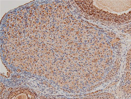 LIMK1 / LIMK Antibody - 1:100 staining rat ovarian tissue by IHC-P. The tissue was formaldehyde fixed and a heat mediated antigen retrieval step in citrate buffer was performed. The tissue was then blocked and incubated with the antibody for 1.5 hours at 22°C. An HRP conjugated goat anti-rabbit antibody was used as the secondary.