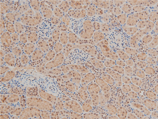LIMK1 / LIMK Antibody - 1:100 staining rat kidney tissue by IHC-P. The tissue was formaldehyde fixed and a heat mediated antigen retrieval step in citrate buffer was performed. The tissue was then blocked and incubated with the antibody for 1.5 hours at 22°C. An HRP conjugated goat anti-rabbit antibody was used as the secondary.