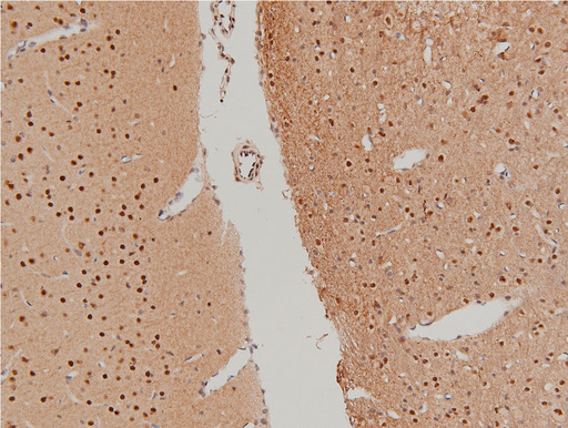 LIMK1 / LIMK Antibody - 1:100 staining rat brain tissue by IHC-P. The tissue was formaldehyde fixed and a heat mediated antigen retrieval step in citrate buffer was performed. The tissue was then blocked and incubated with the antibody for 1.5 hours at 22°C. An HRP conjugated goat anti-rabbit antibody was used as the secondary.