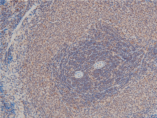 LIMK1 / LIMK Antibody - 1:100 staining rat spleen tissue by IHC-P. The tissue was formaldehyde fixed and a heat mediated antigen retrieval step in citrate buffer was performed. The tissue was then blocked and incubated with the antibody for 1.5 hours at 22°C. An HRP conjugated goat anti-rabbit antibody was used as the secondary.