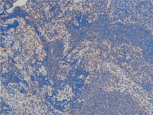 LIMK1 / LIMK Antibody - 1:100 staining rat thymus tissue by IHC-P. The tissue was formaldehyde fixed and a heat mediated antigen retrieval step in citrate buffer was performed. The tissue was then blocked and incubated with the antibody for 1.5 hours at 22°C. An HRP conjugated goat anti-rabbit antibody was used as the secondary.