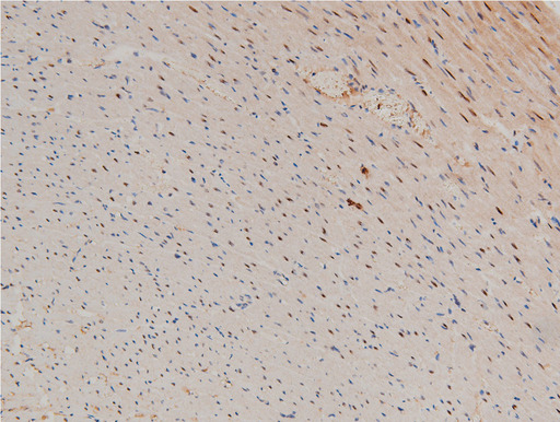 LIMK1 / LIMK Antibody - 1:100 staining rat heart tissue by IHC-P. The tissue was formaldehyde fixed and a heat mediated antigen retrieval step in citrate buffer was performed. The tissue was then blocked and incubated with the antibody for 1.5 hours at 22°C. An HRP conjugated goat anti-rabbit antibody was used as the secondary.