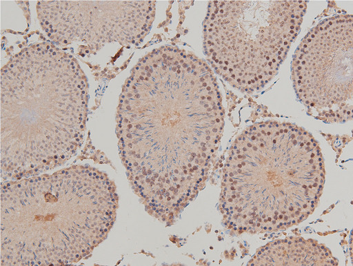 LIMK1 / LIMK Antibody - 1:100 staining rat testis tissue by IHC-P. The tissue was formaldehyde fixed and a heat mediated antigen retrieval step in citrate buffer was performed. The tissue was then blocked and incubated with the antibody for 1.5 hours at 22°C. An HRP conjugated goat anti-rabbit antibody was used as the secondary.