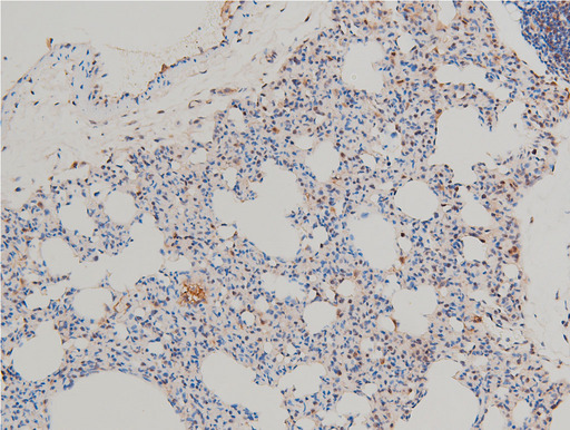 LIMK1 / LIMK Antibody - 1:100 staining rat lung tissue by IHC-P. The tissue was formaldehyde fixed and a heat mediated antigen retrieval step in citrate buffer was performed. The tissue was then blocked and incubated with the antibody for 1.5 hours at 22°C. An HRP conjugated goat anti-rabbit antibody was used as the secondary.