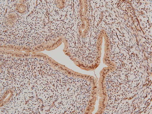 LIMK1 / LIMK Antibody - 1:100 staining rat uterine tissue by IHC-P. The tissue was formaldehyde fixed and a heat mediated antigen retrieval step in citrate buffer was performed. The tissue was then blocked and incubated with the antibody for 1.5 hours at 22°C. An HRP conjugated goat anti-rabbit antibody was used as the secondary.