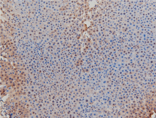 LIMK1 / LIMK Antibody - 1:100 staining rat liver tissue by IHC-P. The tissue was formaldehyde fixed and a heat mediated antigen retrieval step in citrate buffer was performed. The tissue was then blocked and incubated with the antibody for 1.5 hours at 22°C. An HRP conjugated goat anti-rabbit antibody was used as the secondary.