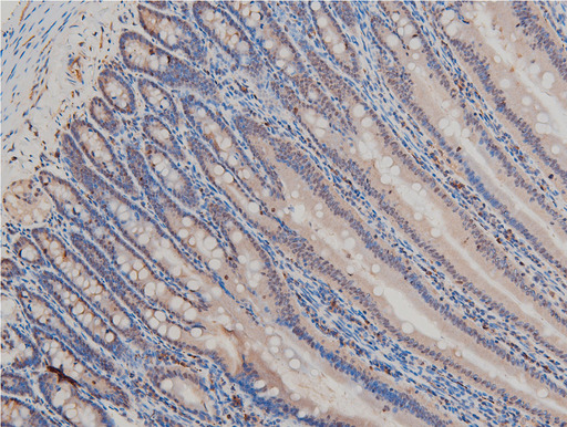 LIMK1 / LIMK Antibody - 1:100 staining rat Intestinal tissue by IHC-P. The tissue was formaldehyde fixed and a heat mediated antigen retrieval step in citrate buffer was performed. The tissue was then blocked and incubated with the antibody for 1.5 hours at 22°C. An HRP conjugated goat anti-rabbit antibody was used as the secondary.