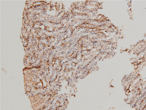 LIMK1 / LIMK Antibody - 1:100 staining mouse kidney tissue by IHC-P. The tissue was formaldehyde fixed and a heat mediated antigen retrieval step in citrate buffer was performed. The tissue was then blocked and incubated with the antibody for 1.5 hours at 22°C. An HRP conjugated goat anti-rabbit antibody was used as the secondary.
