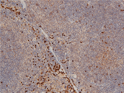 LIMK1 / LIMK Antibody - 1:100 staining mouse spleen tissue by IHC-P. The tissue was formaldehyde fixed and a heat mediated antigen retrieval step in citrate buffer was performed. The tissue was then blocked and incubated with the antibody for 1.5 hours at 22°C. An HRP conjugated goat anti-rabbit antibody was used as the secondary.
