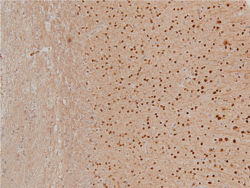 LIMK1 / LIMK Antibody - 1:100 staining mouse brain tissue by IHC-P. The tissue was formaldehyde fixed and a heat mediated antigen retrieval step in citrate buffer was performed. The tissue was then blocked and incubated with the antibody for 1.5 hours at 22°C. An HRP conjugated goat anti-rabbit antibody was used as the secondary.