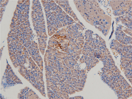 LIMK1 / LIMK Antibody - 1:100 staining mouse pancreas tissue by IHC-P. The tissue was formaldehyde fixed and a heat mediated antigen retrieval step in citrate buffer was performed. The tissue was then blocked and incubated with the antibody for 1.5 hours at 22°C. An HRP conjugated goat anti-rabbit antibody was used as the secondary.