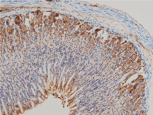 LIMK1 / LIMK Antibody - 1:100 staining mouse gastric tissue by IHC-P. The tissue was formaldehyde fixed and a heat mediated antigen retrieval step in citrate buffer was performed. The tissue was then blocked and incubated with the antibody for 1.5 hours at 22°C. An HRP conjugated goat anti-rabbit antibody was used as the secondary.