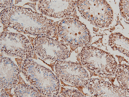 LIMK1 / LIMK Antibody - 1:100 staining mouse testis tissue by IHC-P. The tissue was formaldehyde fixed and a heat mediated antigen retrieval step in citrate buffer was performed. The tissue was then blocked and incubated with the antibody for 1.5 hours at 22°C. An HRP conjugated goat anti-rabbit antibody was used as the secondary.