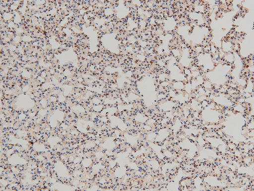 LIMK1 / LIMK Antibody - 1:100 staining mouse lung tissue by IHC-P. The tissue was formaldehyde fixed and a heat mediated antigen retrieval step in citrate buffer was performed. The tissue was then blocked and incubated with the antibody for 1.5 hours at 22°C. An HRP conjugated goat anti-rabbit antibody was used as the secondary.