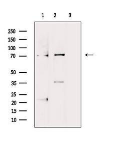 LIMK1 / LIMK Antibody - Western blot analysis of extracts of HeLa cells, HeLa+H2o2 cells and p-peptide rat brain tissue using Phospho-LIMK1 (Thr508) antibody at 1:1000 dilution.; Lane 1 : HeLa cells extract; Lane 2 : HeLa+H2o2 cells extract; lane 3 : p-peptide rat brain tissue;