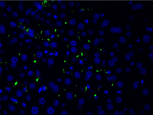 LIMK1 / LIMK Antibody - 1:200 staining human liver cells by IF/ICC. cells were formaldehyde fixed, permeabilized by Triton X-100 and blocked 5% BSA for 30 min at room temperature. The sample was incubated with the primary antibody (1:200 in BSA) for 1 hour. An Alexa Fluor 488®-conjugated Goat anti-rabbit antibody was used as the secondary.