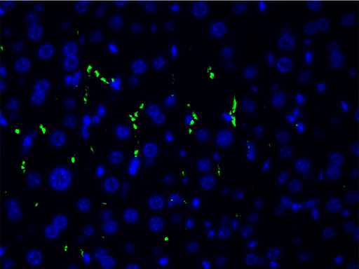 LIMK1 / LIMK Antibody - 1:200 staining human gastric tissue cells by IF/ICC.
