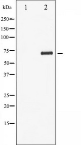 LIMK1 / LIMK Antibody - Western blot analysis of LIMK1 phosphorylation expression in COLO205 whole cells lysates. The lane on the left is treated with the antigen-specific peptide.