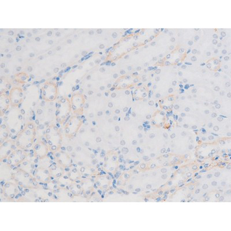 LIMK1 / LIMK Antibody - 1:200 staining mouse kidney tissue by IHC-P. The tissue was formaldehyde fixed and a heat mediated antigen retrieval step in citrate buffer was performed. The tissue was then blocked and incubated with the antibody for 1.5 hours at 22°C. An HRP conjugated goat anti-rabbit antibody was used as the secondary.