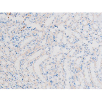 LIMK1 / LIMK Antibody - 1:200 staining mouse kidney tissue by IHC-P. The tissue was formaldehyde fixed and a heat mediated antigen retrieval step in citrate buffer was performed. The tissue was then blocked and incubated with the antibody for 1.5 hours at 22°C. An HRP conjugated goat anti-rabbit antibody was used as the secondary.