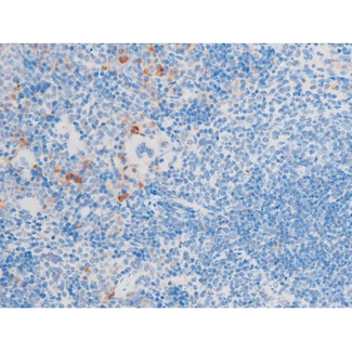 LIMK1 / LIMK Antibody - 1:200 staining mouse spleen tissue by IHC-P. The tissue was formaldehyde fixed and a heat mediated antigen retrieval step in citrate buffer was performed. The tissue was then blocked and incubated with the antibody for 1.5 hours at 22°C. An HRP conjugated goat anti-rabbit antibody was used as the secondary.