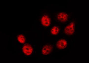 LIMK1 / LIMK Antibody - Staining NIH-3T3 cells by IF/ICC. The samples were fixed with PFA and permeabilized in 0.1% Triton X-100, then blocked in 10% serum for 45 min at 25°C. The primary antibody was diluted at 1:200 and incubated with the sample for 1 hour at 37°C. An Alexa Fluor 594 conjugated goat anti-rabbit IgG (H+L) Ab, diluted at 1/600, was used as the secondary antibody.