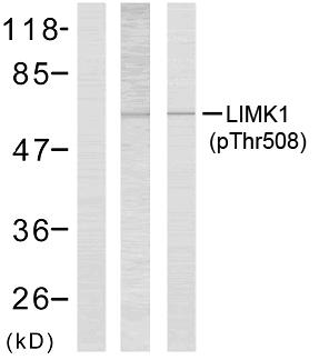 LIMK1 / LIMK Antibody - Western blot analysis of extracts using LIMK1 (phospho-Thr508) antibody.
