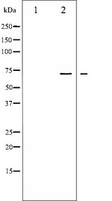 LIMK1 / LIMK Antibody - Western blot analysis of LIMK1/2 phosphorylation expression in HeLa whole cells lysates. The lane on the left is treated with the antigen-specific peptide.