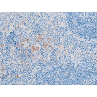 LIMK1 / LIMK Antibody - 1:200 staining mouse spleen tissue by IHC-P. The tissue was formaldehyde fixed and a heat mediated antigen retrieval step in citrate buffer was performed. The tissue was then blocked and incubated with the antibody for 1.5 hours at 22°C. An HRP conjugated goat anti-rabbit antibody was used as the secondary.
